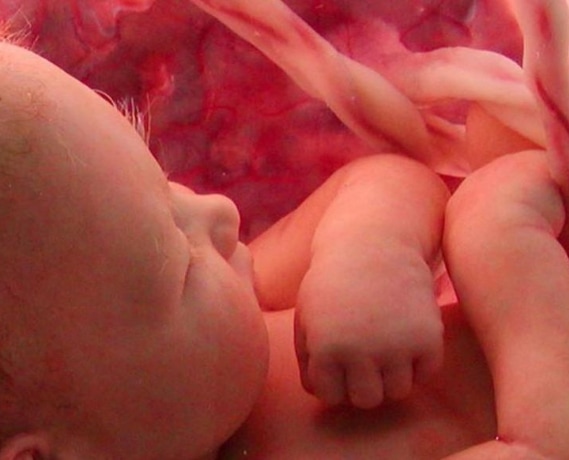 Fetal DNA Testi - Op. Dr. Ali Gürsoy - Maltepe Kadın Doğum Doktoru
