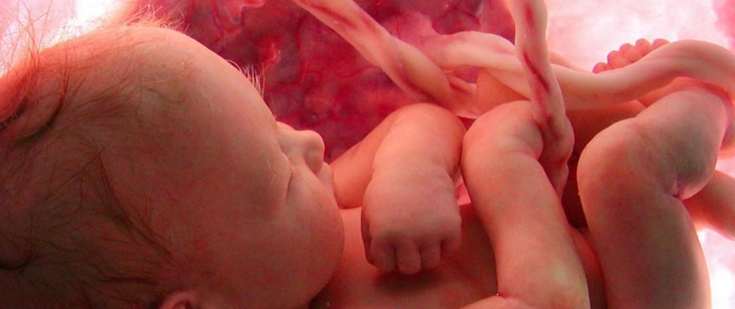 Fetal DNA Testi - Op. Dr. Ali Gürsoy - Maltepe Kadın Doğum Doktoru